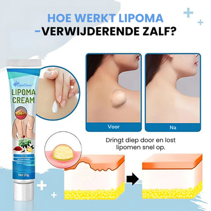 LipoClear™ Crème | Laat vetbultjes op natuurlijke wijze verdwijnen in slechts 7 dagen!